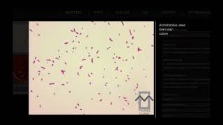 Actinobacillus ureae  Microbiology [upl. by Ramonda]