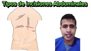 Tipos de incisiones Abdominales [upl. by Marigolda]