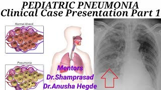 PEDIATRIC PNEUMONIA Part 1 Clinical Case Presentation [upl. by Clifford]