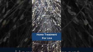 Home Treatment For Lice  Hair Regrowth  Hair Loss  Hair Tips  Adon Hair Care viralshort [upl. by Alesig882]