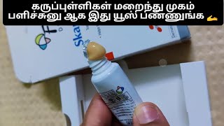 fixderma skarfix cream review in Tamil  scar fix  melasma pigmentation [upl. by Elorac]