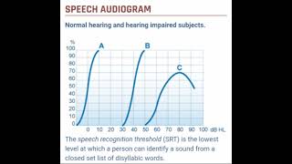 Speech Audiometry [upl. by Yaker]