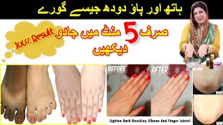 INSTANT HANDS FEET KNUCKLES WHITENING in 5 MINUTES in URDU  HINDI  DR BILQUIS SHAIKH [upl. by Eelhsa125]