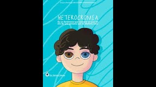 Heterocromía hereditaria [upl. by Biancha588]