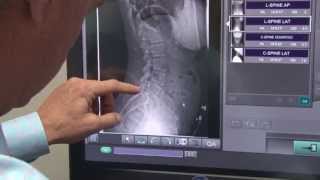 Chiropractor Dr Terry Smedstad  Houston TX [upl. by Nofets]