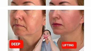 DEEP LIFTING massage  Sagging Jowls  Nasolabial Folds  Double chin [upl. by Nahallac400]