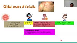 240515 Varicella Zoster virus  Treatment and prevention [upl. by Juline]