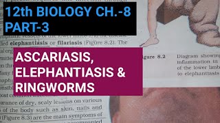 Class 12 biology chapter 8part 3human diseasesStudy with Farru [upl. by Enael]