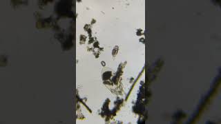 Rotifer under a microscope science short biology [upl. by Kcirevam121]