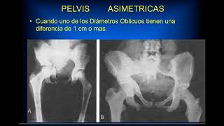 22° CLASE DE DISTOCIA DEL PARTO DR BOLATTI [upl. by Tuddor]