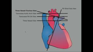 Advanced Evaluation of the Fetal Heart [upl. by Michigan]