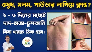 3 effective Remedies for Itching Problem In Private Parts Skin Fungal Infection দাদহাজাচুলকানি । [upl. by Nnodnarb]