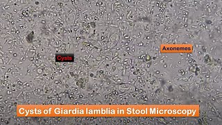 Stool Faeces Saline Wet Mount Preparation and Microscopy showing Giardia at various magnifications [upl. by Nednarb]