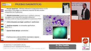 Aciertos y errores en el diagnóstico dermatológico en la criptococosis cutánea Dr Eloy Castilla [upl. by Anytsyrk526]