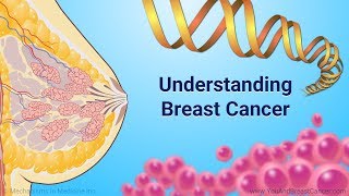 Understanding Breast Cancer [upl. by Donall]