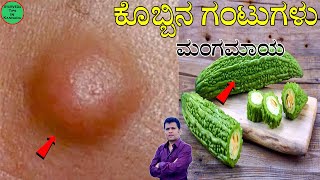 Lipoma Ayurvedic Treatment  lipoma mane maddu  lipoma ayurvedic treatment kannada  kobbina gantu [upl. by Malvino]