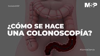 ¿Cómo se hace una colonoscopía ExclusivoMSP [upl. by Lasko]