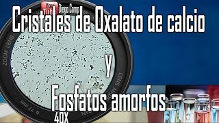 Cristales de oxalato de calcio monohidratado y Uratos amorfos  Uroanalisis [upl. by Heintz]