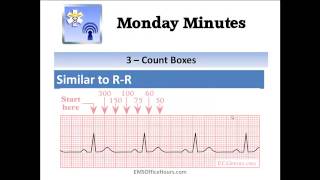 ECG Recognition Tips  P Waves QRS amp Rate [upl. by Aynuat]