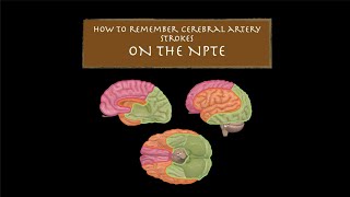 How to Remember Three Cerebral Artery Strokes on the NPTE [upl. by Enened]