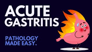 Acute Gastritis Pathology Simplified MUST KNOW [upl. by Cressida]