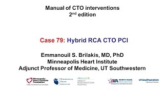 Case 79 Manual of CTO Interventions  Hybrid RCA CTO PCI [upl. by Naejamron319]