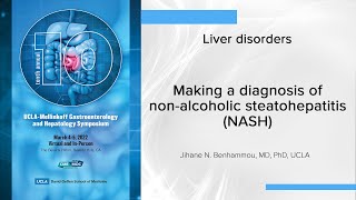 Making a diagnosis of nonalcoholic steatohepatitis NASH  UCLA Digestive Diseases [upl. by Inar]