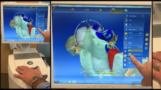 CEREC Dental Assistant Training Basics  Single Crown Setup Imaging Design  Overview [upl. by Liz562]