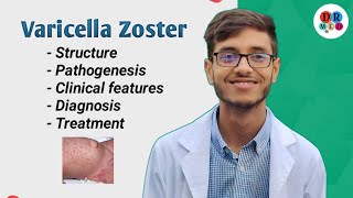 Chickenpox  Varicella zoster  Shingles  Human Herpes virus 6 7 8  Microbiology bangla lecture [upl. by Nosiram]