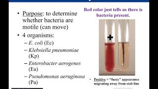 Lab 528 Motility Test [upl. by Nagad]