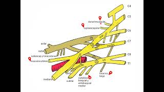 plexo braquial evaluacion electrodiagnóstica [upl. by Swayne]