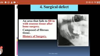 Differential Diagnosis Of Radiolucent Lesions LEC3Of Elearning [upl. by Anal]