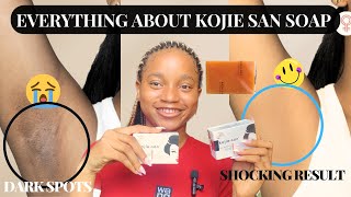 HOW TO EFFECTIVELY USE KOJIE SAN SOAP  Kojie San Soap Detailed Review [upl. by Noscire]