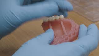 Lucitone Digital Denture [upl. by Hyrup142]