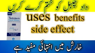 terbiderm lotion terbenafin hcl uses benefits side effectterbiderm lotion uses in urdu hindi [upl. by Novek]