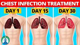 7 Natural Chest Infection Treatments Home Remedies [upl. by Melone]