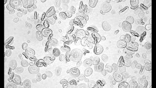 Heat Gelatinization of Wheat Starch low iodine [upl. by Radke993]