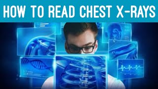 How to Read and Interpret a Chest Xray Made Easy Quick amp EZ Episode 20 [upl. by Noakes]