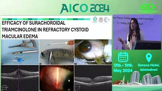 3rd Best PaperAICO 2024Suprachoroidal Triamcinolone In Refractory Cases of Cystoid Macular Edema [upl. by Rennob]