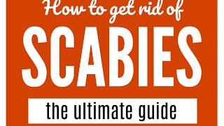 How To Get Rid Of Scabies A Guide That WORKS [upl. by Pevzner]