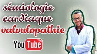 sémiologie cardiaque valvulopathie gauche [upl. by Nagey41]