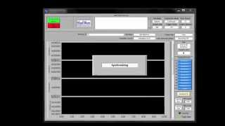 Data Acquisition with the MindWare Mobile Impedance Cardiograph [upl. by Diraf648]