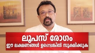 എന്താണ് ലൂപസ് രോഗം  SLE or Lupus Disease Malayalam Health Tips [upl. by Leirbag]