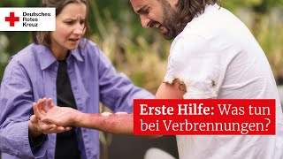 Erste Hilfe Was tun bei Verbrennungen [upl. by Ydderf128]