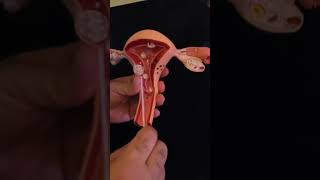 how do we get a uterine endometrial biopsy [upl. by Alyam231]