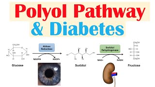 Polyol Pathway amp Diabetes  The Role of Polyol Pathway in Diabetes Pathogenesis [upl. by Nebra]