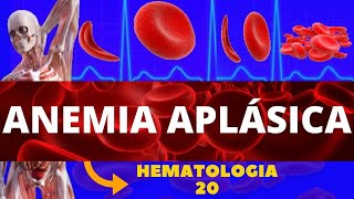 ANEMIA APLÁSICA ESTUDO DAS ANEMIAS  HEMATOLOGIA [upl. by Aelyk]