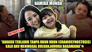 NAMIRA MONDA quotANAKKU TERLAHIR TANPA UBUN UBUN CRANIOSYNOSTOSIS🥹” [upl. by Savior]