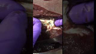 Fasciola hepatica liver fluke adult extraction from a cow [upl. by Lennon]