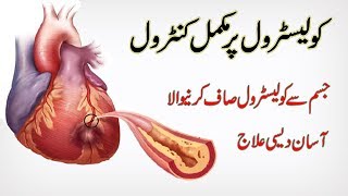 Cholesterol Kam Karne Ke Gharelu Ilaj In Urdu  How to control cholesterol In UrduHindi [upl. by Sheela]